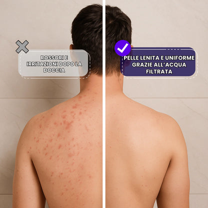 Soffione doccia anticalcare